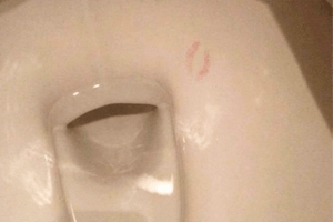 Ähm, BÄH! Wie konnte dieser Lippenabdruck bitte in eine Toilettenschüssel kommen?!!
